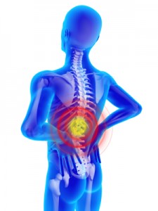 Back Injuries Benefit from BioMat Negative Ions